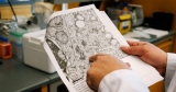 CDC warns of virus that can cause polio-like muscle weakness among kids