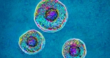 Doctors urge more research into little-known STI linked to infertility in men and women