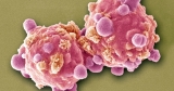 Novel leukemia therapy aims to treat sick kids before time runs out