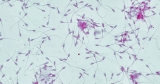 Falling sperm count observed around the world, study finds