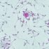 Scientists explore new strategy for covid-19 treatments