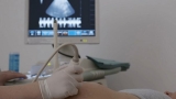 Video Abortions decrease over past decade: CDC – ABC News