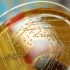 Improved Dietary Supplement For Age-Related Macular Degeneration
