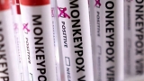 Second probable case of monkeypox in Oakland County has been reported, officials say