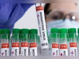 Health News Roundup: Britain faces ‘humanitarian crisis’ as energy costs soar, says health lobby; Cuba confirms first monkeypox case in visitor from Italy and more
