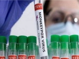 Health News Roundup: Shanghai cancels auto event as rising COVID cases add to reopening worries; WHO plans to rename monkeypox to ‘MPOX’ – Politico and more