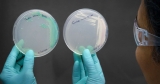 C.D.C. Warns of Superbug Fungus Outbreaks in 2 Cities