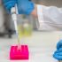 How and why the pandemic has fuelled disordered eating
