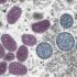 CDC Raises Delaware’s COVID-19 Community Levels To High – CBS Philly