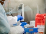 Health News Roundup: For many weary Chinese, lockdown dread trumps fear of COVID; FDA receives reports of cancer linked to breast implants and more