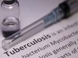 Health News Roundup: Tuberculosis deaths rose during pandemic, reversing years of decline – WHO; New frontline of U.S. abortion battles emerges in New Mexico and more