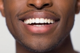 Best Teeth Whitening Kits on the Market
