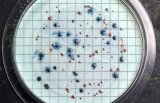 CDC investigating E. Coli outbreak in Ohio, Michigan