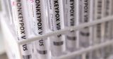 U.S. CDC confirms evidence of local monkeypox transmission