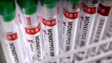 VDH expands monkeypox vaccine eligibility, aligns with CDC criteria