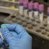 Ottawa County reported 100 additional COVID-19 cases this week
