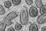 Health News Roundup: Factbox-Monkeypox cases around the world; UAE reports three more monkeypox cases and more