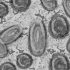 Cuyahoga and Lorain counties out of CDC’s ‘high’ COVID level
