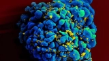 World’s first woman ‘cured’ of HIV using rare treatment