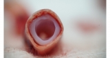 Revotek Receives Clearance from the National Health Commission of China for the World First Clinical Trial for 3D Bioprinted Stem Cell Vascular Grafts