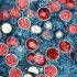 Travel restrictions significantly reduced COVID-19 cases entering Canada — but insufficient to prevent new outbreaks