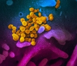 Arizona weekly COVID-19 update adds 13,410 cases, 62 deaths