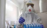 US study on mice suggests COVID-19 infection may increase risk of Parkinson’s disease