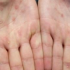 Novavax COVID-19 vaccine to be considered by FDA panel as 4th in US