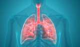 Experts Warn of Spread of Lung Infection-Causing Fungi