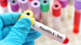 State warns of potential hepatitis A exposure at Boothbay store