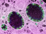 New Mutant XE Omicron Variant May Be Most Transmissible Covid Yet – Deadline