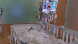 CDC says most children will get RSV by age 2 – NBC 15 WPMI
