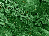 COVID sewage surveillance labs join the hunt for monkeypox
