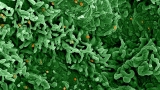 COVID sewage surveillance labs join the hunt for monkeypox : Shots