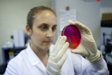 CDC: Minnesotans sickened by salmonella from unknown food source