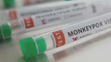 "It felt like AIDs again:" LGBT+ leader says stigma rising for gay men due to monkeypox – WSBT-TV