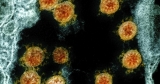 Cayuga County has ‘medium’ COVID community level, CDC says | Local News | Auburn, NY | Auburnpub.com