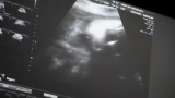 CDC issues health advisory, recommends COVID vaccine for those who are pregnant | Local News