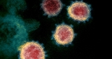Cayuga one of 17 U.S. counties with high COVID-19 levels, CDC says | Local News | Auburn, NY | Auburnpub.com