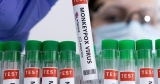 U.S. health officials releasing some Jynneos vaccine doses for monkeypox – CDC | U.S. & World