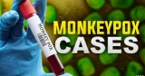Maryland’s Monkeypox Case Count Rises to 22 | Latest News