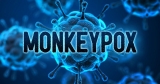 Md. Surpasses 100 Monkeypox Cases, Vaccines Remain Scarce | Latest News