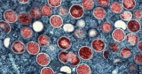 Monkeypox Cases in Maryland Reaches 111, CDC Data Show | Latest News