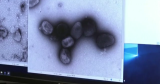 Suspect case of human-to-dog monkeypox transmission leads to CDC updated guidance | National News
