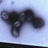 New COVID bivalent vaccine expected in US in the fall