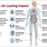 Research shows ‘long Covid’ a major health crisis | News