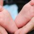 How Dehydration Affects Arthritis and Joint Pain