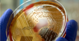 CDC issues warning over invasive strep A cases after at least 2 kids die in US | Northwest & National News