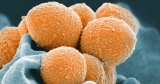 CDC Monitoring Reported Increase In Strep A Cases In Children