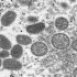 Dane County drops to medium levels of COVID-19, according to CDC
